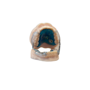 propulseur-universel-light-réalisations orthodontie