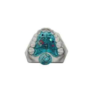 Plaque d'expansion Appareil princesse des neiges orthodontiste
