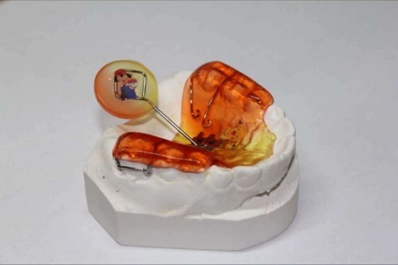 Surrélévation molaires